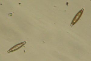 Diatoms