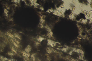 Spirogyra zygospores