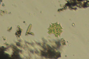 Hydrodictyaceae, diatom