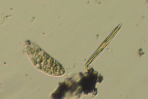 Diatom, spirotrich