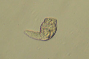 Gnesiotroch larva