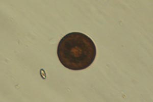 Arcellid shell