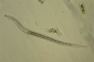 Roundworm, Tubulinea