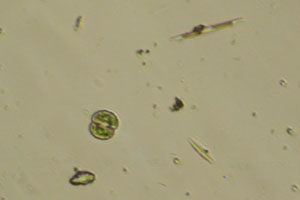 Cosmarium, diatoms