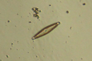 Diatom