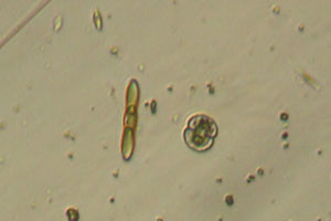 Diatom, Cosmarium