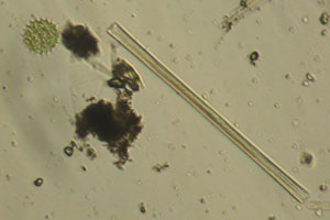 Diatoms, Hydrodictyaceae