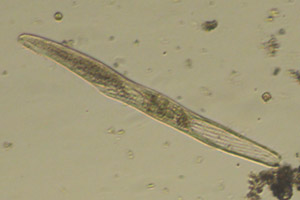 Spirostomum