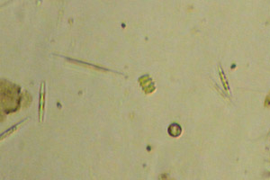 Scenedesmaceae, diatoms