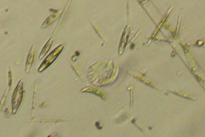Aspidisca, diatoms