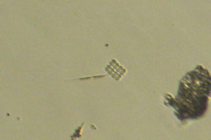 Merismopedia, diatom