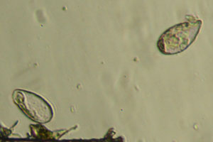 Trinema enchelys shells