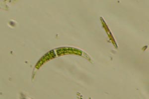 Closterium, diatom