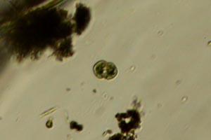 Cosmarium, diatom