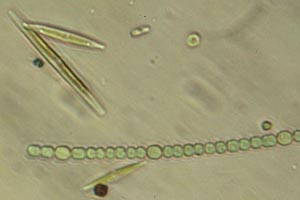 Nostocales, diatoms
