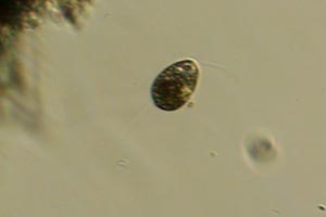 Euglenozoa