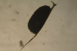Water flea ephippium