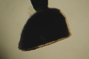 Water flea ephippium