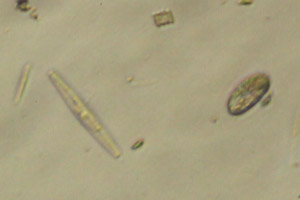 Ciliate, diatom