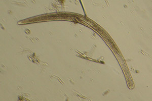 Spirostomum