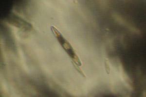 Diatom