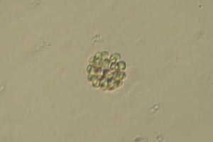 Uroglenopsis