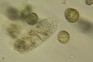 Spirotrich, dinoflagellates