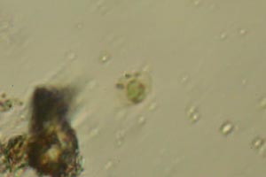 Chlorophyte