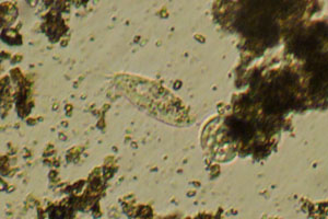 Spirotrich, ciliate