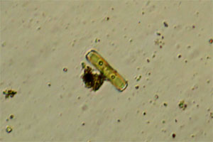 Diatom