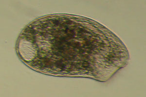 Climacostomum